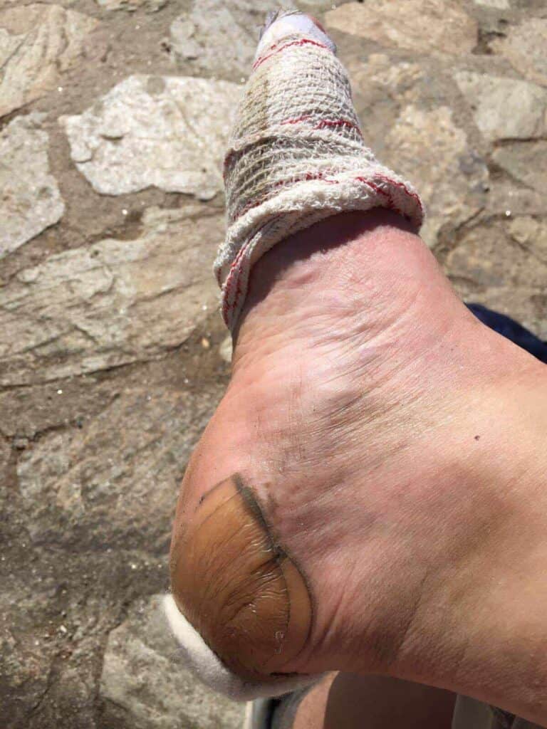 Compeed Blister Prevention
